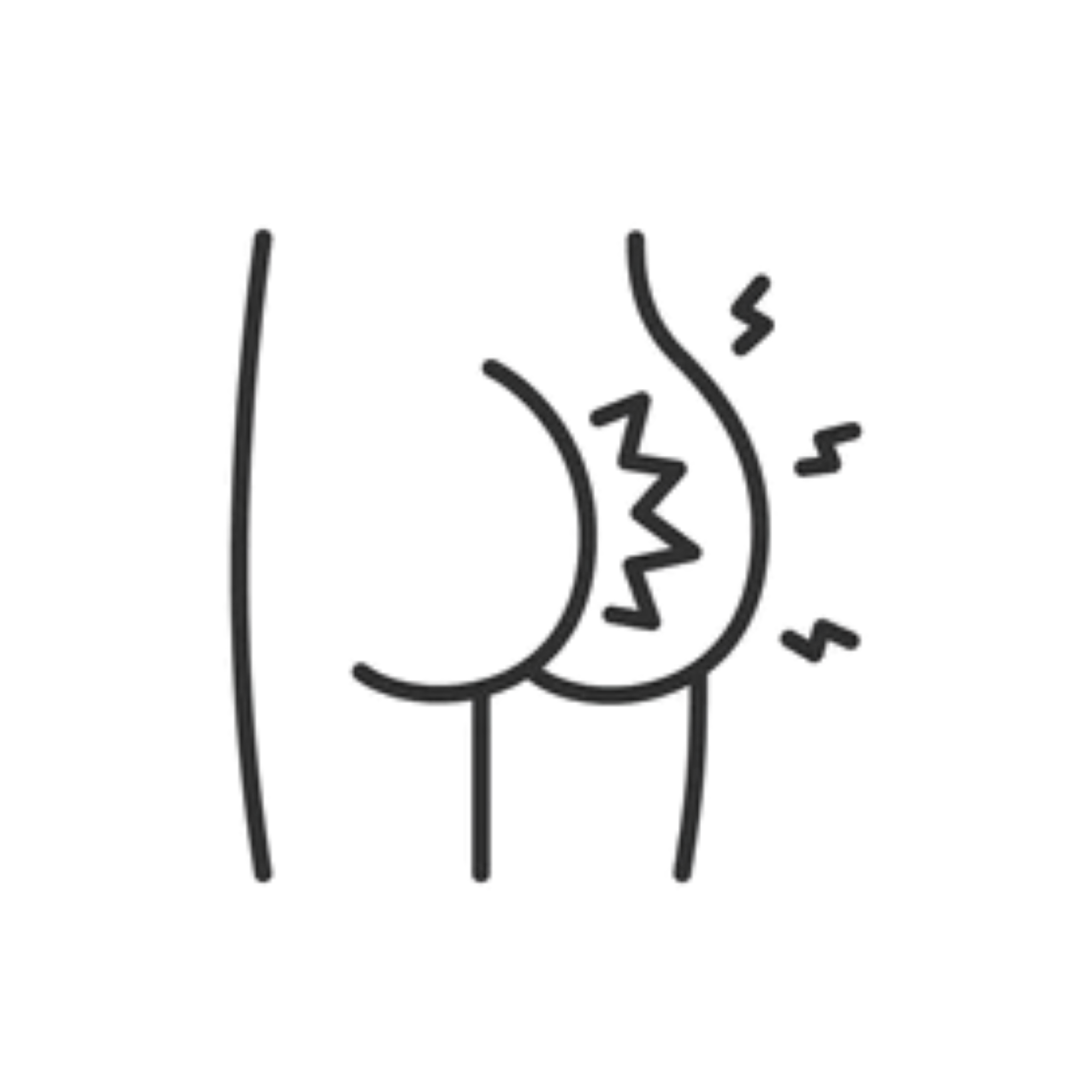 Anal Fissure