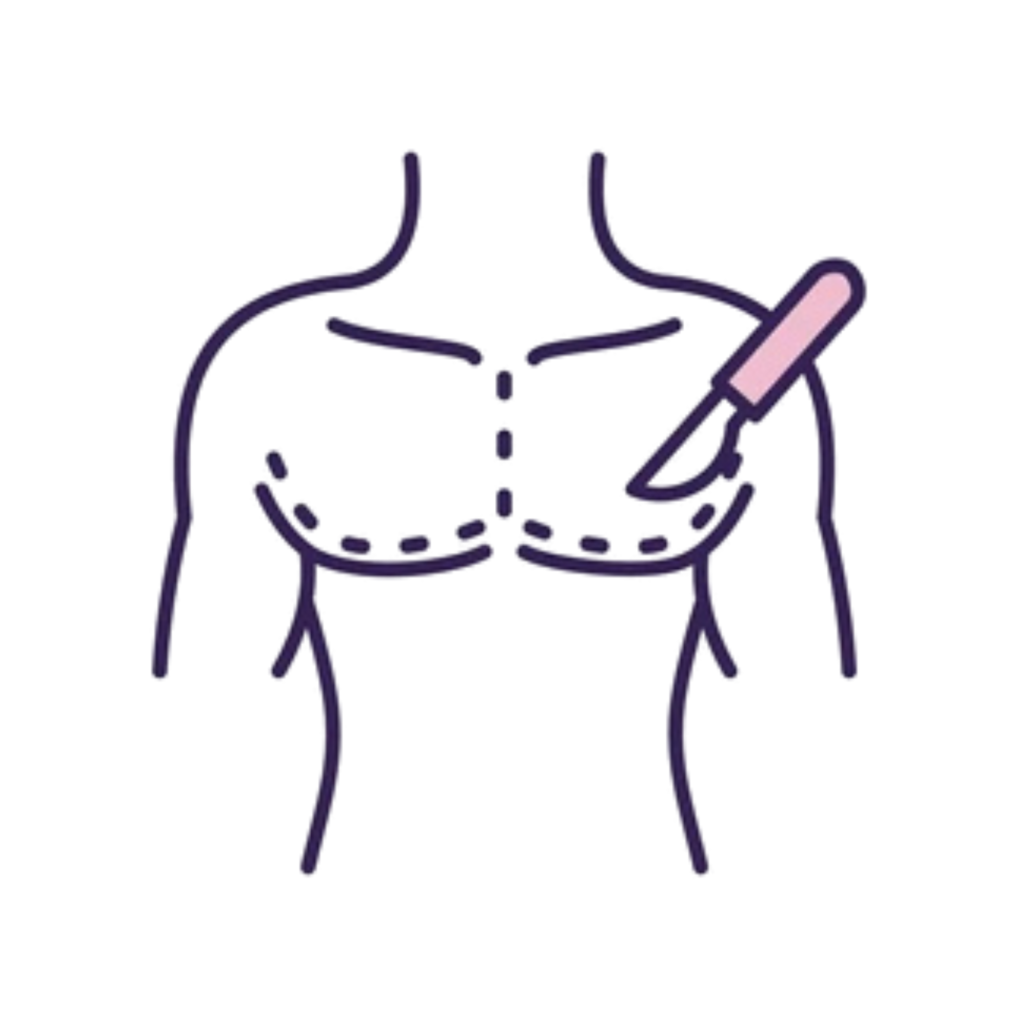 Gynecomastia