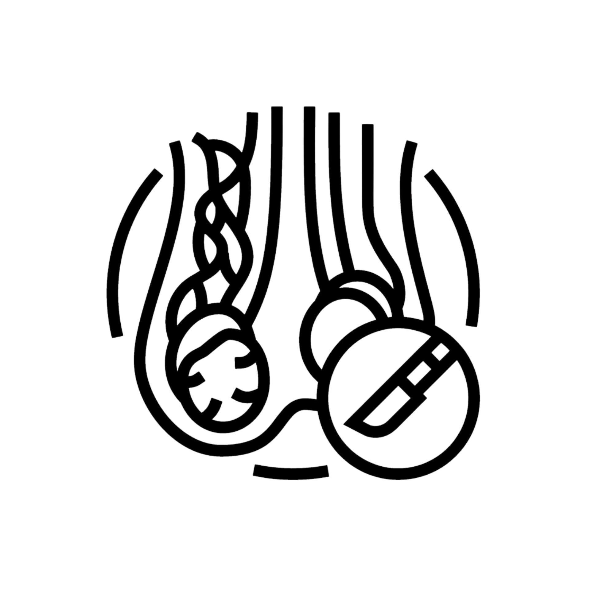 Varicocele